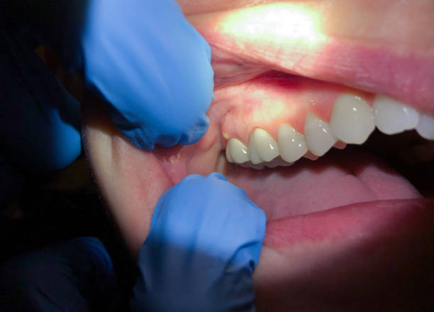 Best Urgent Dental Care for Toothaches in Cloverport, KY