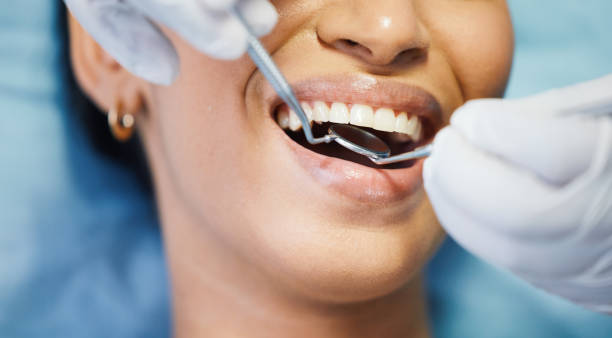 Best Knocked-Out Tooth (Avulsed Tooth) Treatment in Cloverport, KY